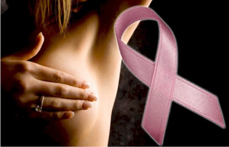 Žene najčešće obolijevaju od raka dojke (Arhiva)